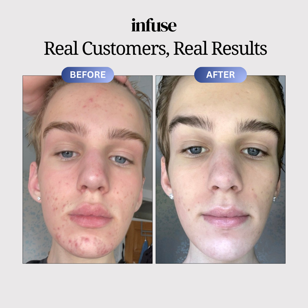 Copper Peptide Skin™ Reset Serum