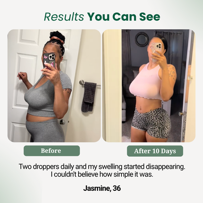 Post Op Lymphatic Drainage Drops