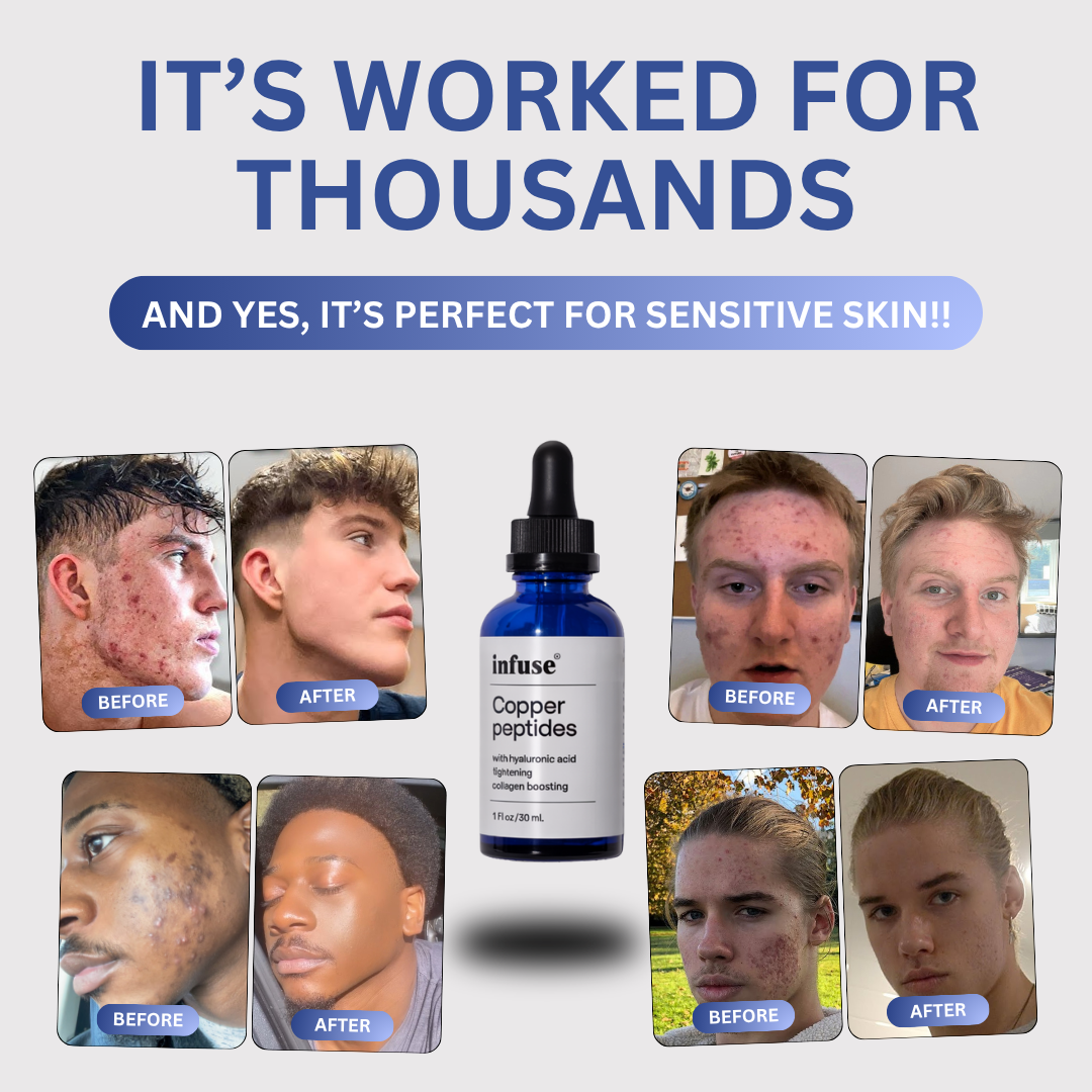 Copper Peptide Skin™ Reset Serum