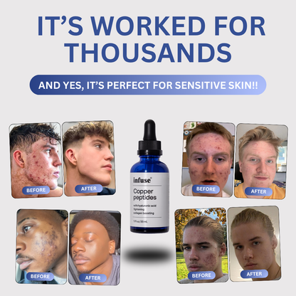 Copper Peptide Skin™ Reset Serum